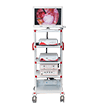 Optical Endoscope