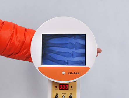 Portable Fluoroscopy Handheld Veterinary and Human X-ray Machine
