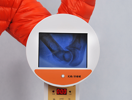 Portable Fluoroscopy Handheld Veterinary and Human X-ray Machine