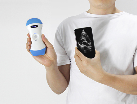 Handheld 3 in 1 Wireless Color Doppler Ultrasound for Phone